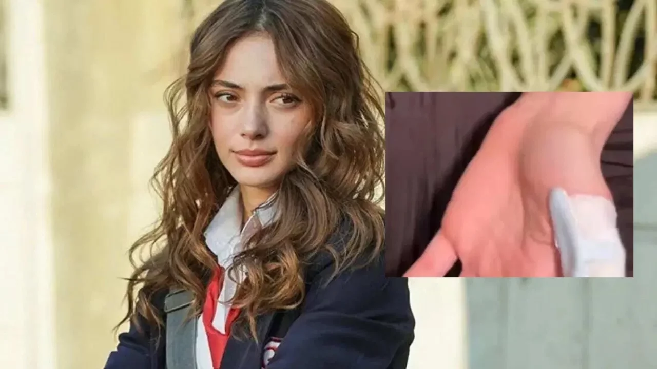 Dizisi setinde korkunç kaza! Rabia Soytürk'ün parmağı kopma noktasına geldi