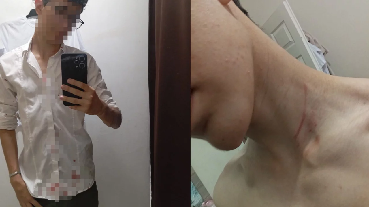 İstanbul'da 16 yaşındaki çocuğu "fotoğraf çektin" iddiasıyla darbettiler