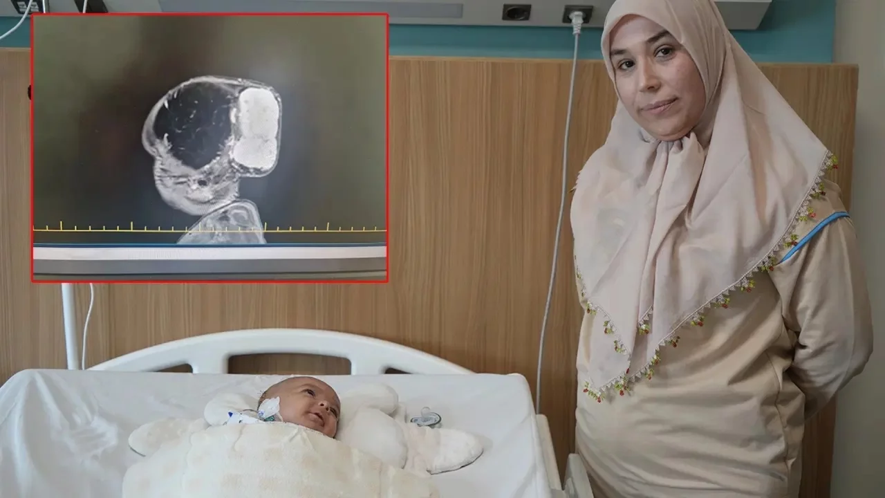 Minik Talha'nın kafasındaki 'dev' kitle 4 saatte çıkarıldı