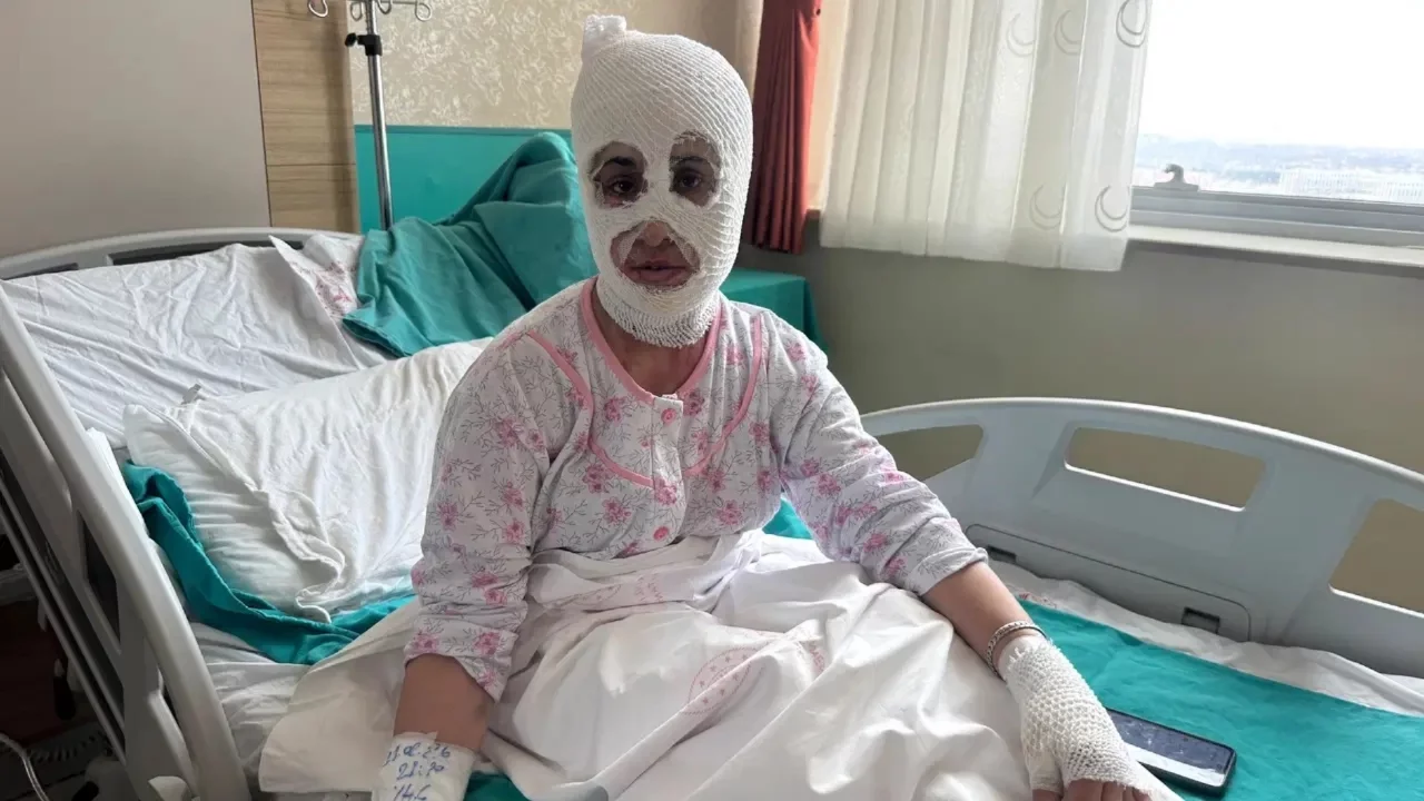 'Düdüklü tencere' faciası: Bomba gibi patladı! 'Aynaya baktıktan sonra bayılmışım...'