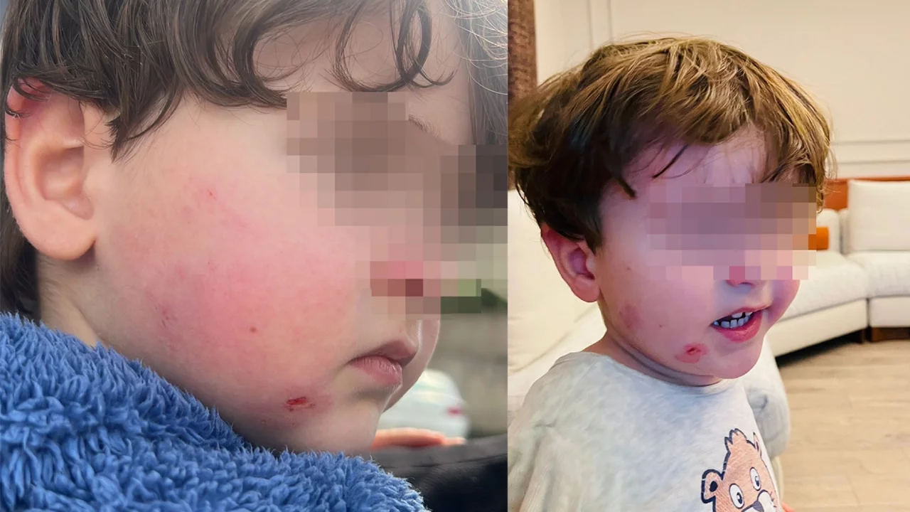 Bursa'da kreşe bıraktığı çocuğunu darp edilmiş halde aldı