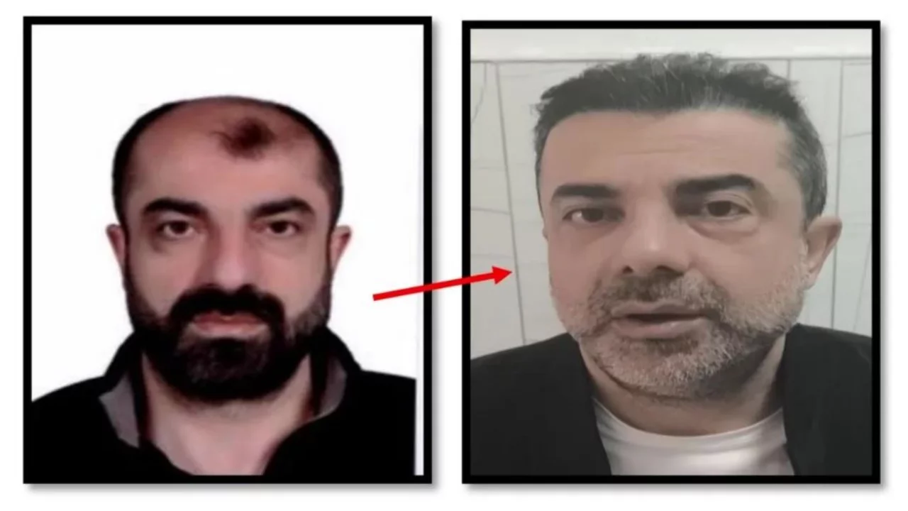 Ameliyat ile yüzünü değiştiren firari cinayet zanlısı 7 yıl sonra yakalandı