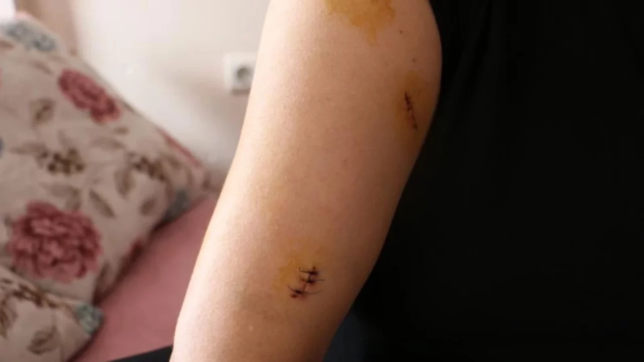 Diyarbakır'da dehşet! Apartman girişinde pusu kurarak 30 yerinden bıçakladı