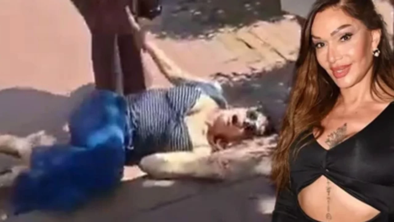 Eski manken Sevda Demirel Maçka Parkı'nda kaza geçirerek ayağını kırdı
