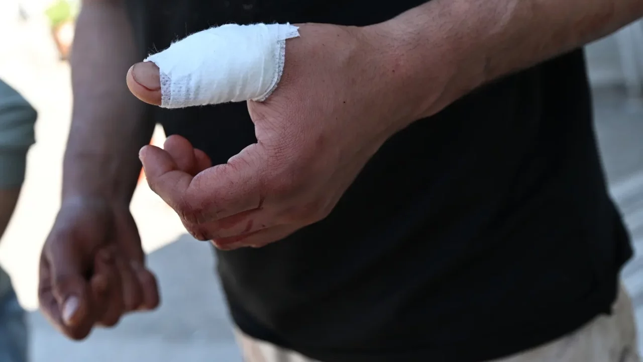 Acemi kasaplar hastanelik oldu: Kurban kesimi sırasında 13 bin 513 kişi yaralandı