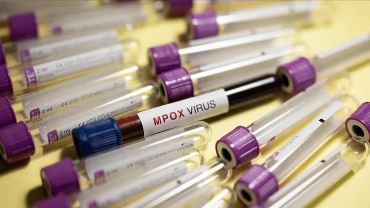 Mpox salgını büyüyor: Ülkede vaka sayısı 2 bini aştı