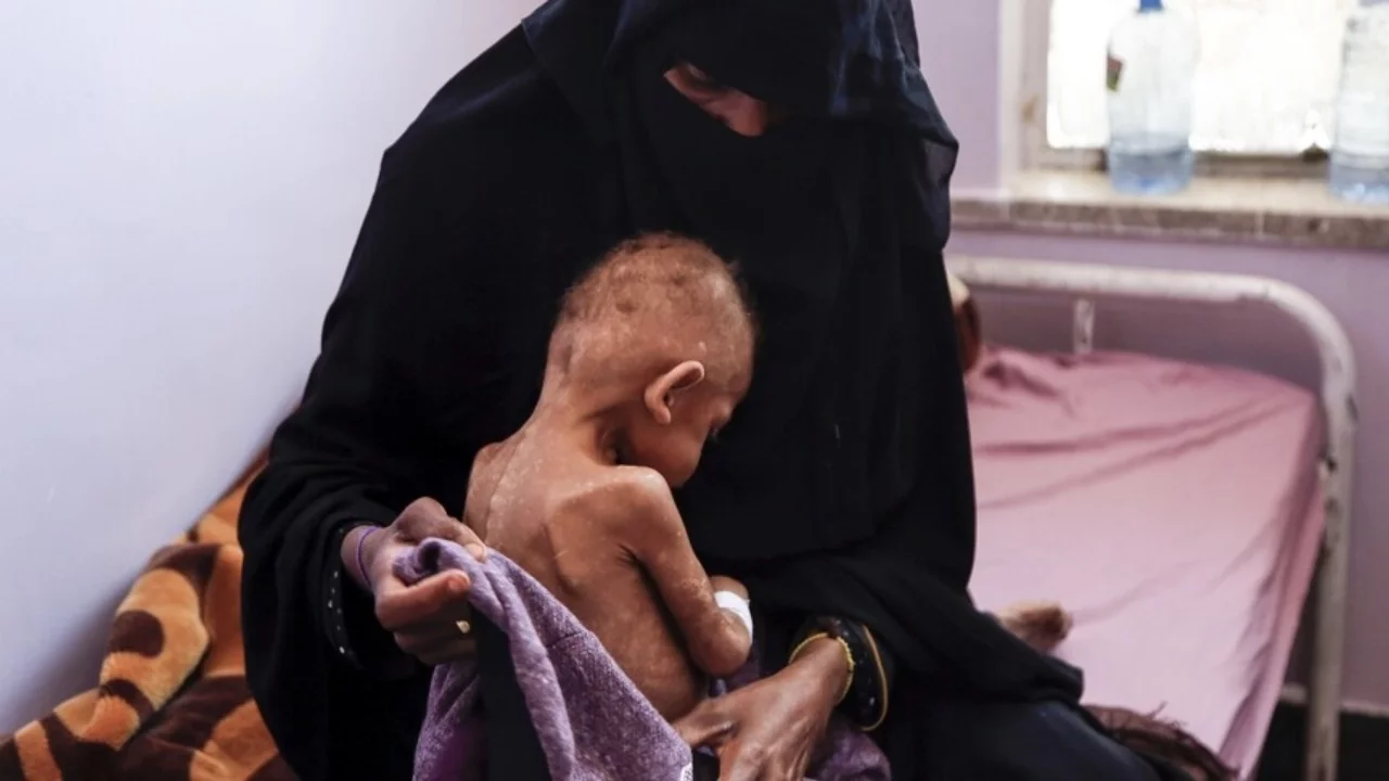 BM'den Yemen uyarısı: 18 milyondan fazla insan açlıkla mücadele ediyor