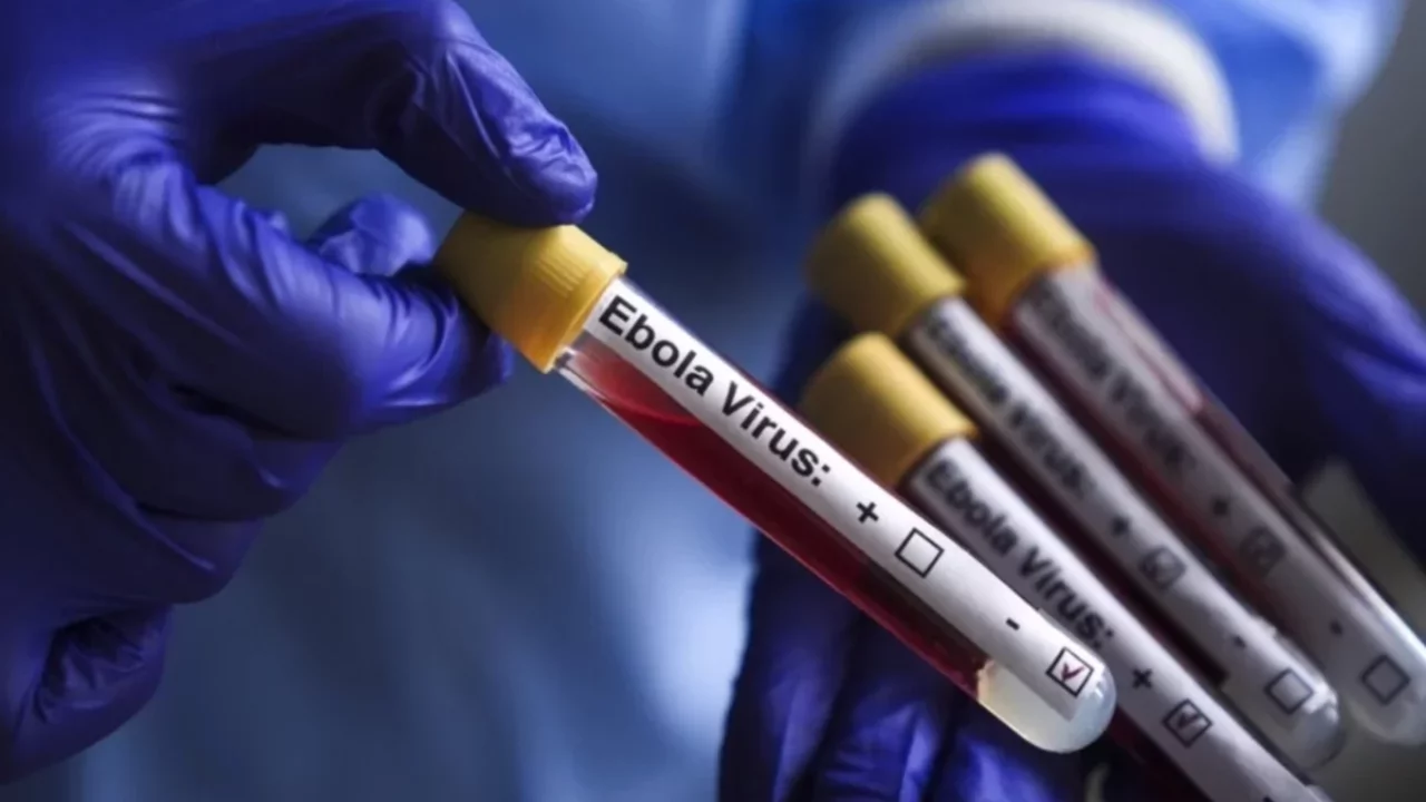 İsrail'de ilk kez Ebola şüphesiyle bir kişi karantinaya alındı