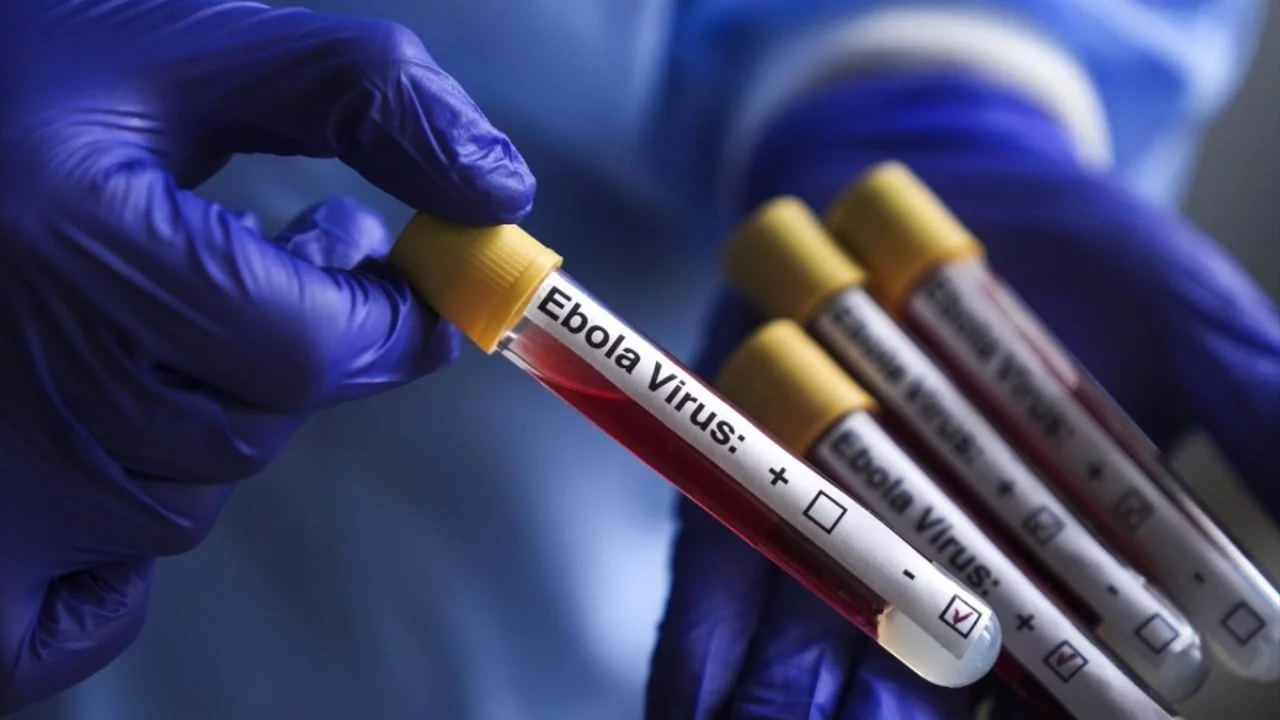 Fransa'da Ebola vakasıyla temas ettiği düşünülen 5 kişi karantinaya alındı