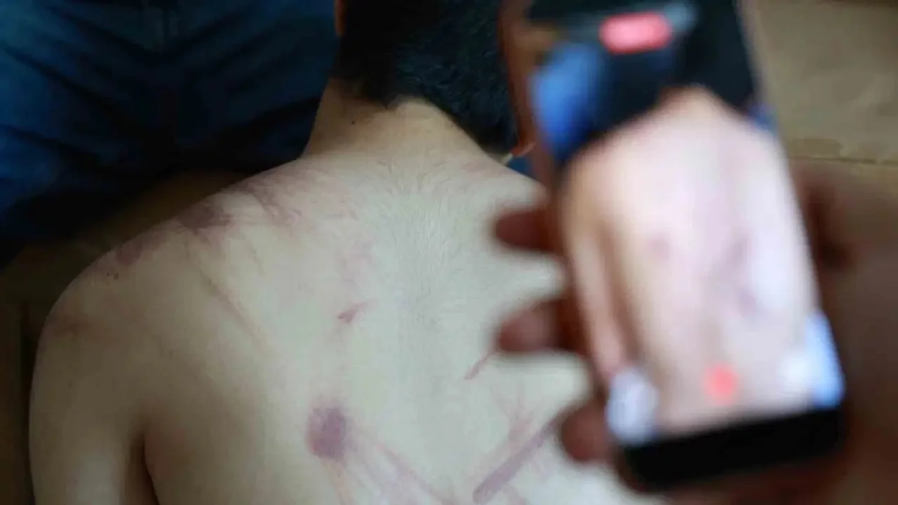 Elazığ'da rehabilitasyon merkezinde 'şiddet' iddiası