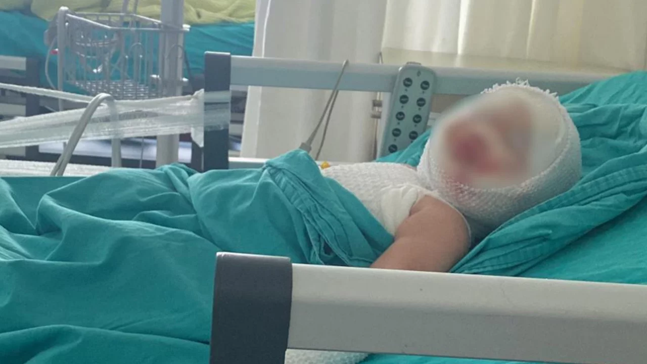 Patlayan domates konservesi 9 aylık bebeği yaktı