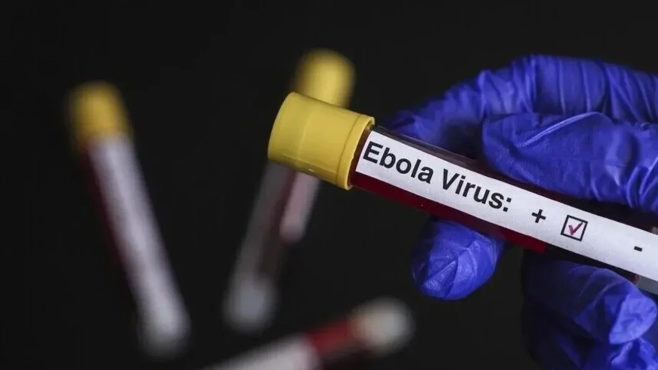 DSÖ'den ebola açıklaması: Ülkede 5 bin 794 vaka ile 2 bin 786 ölüm bildirildi