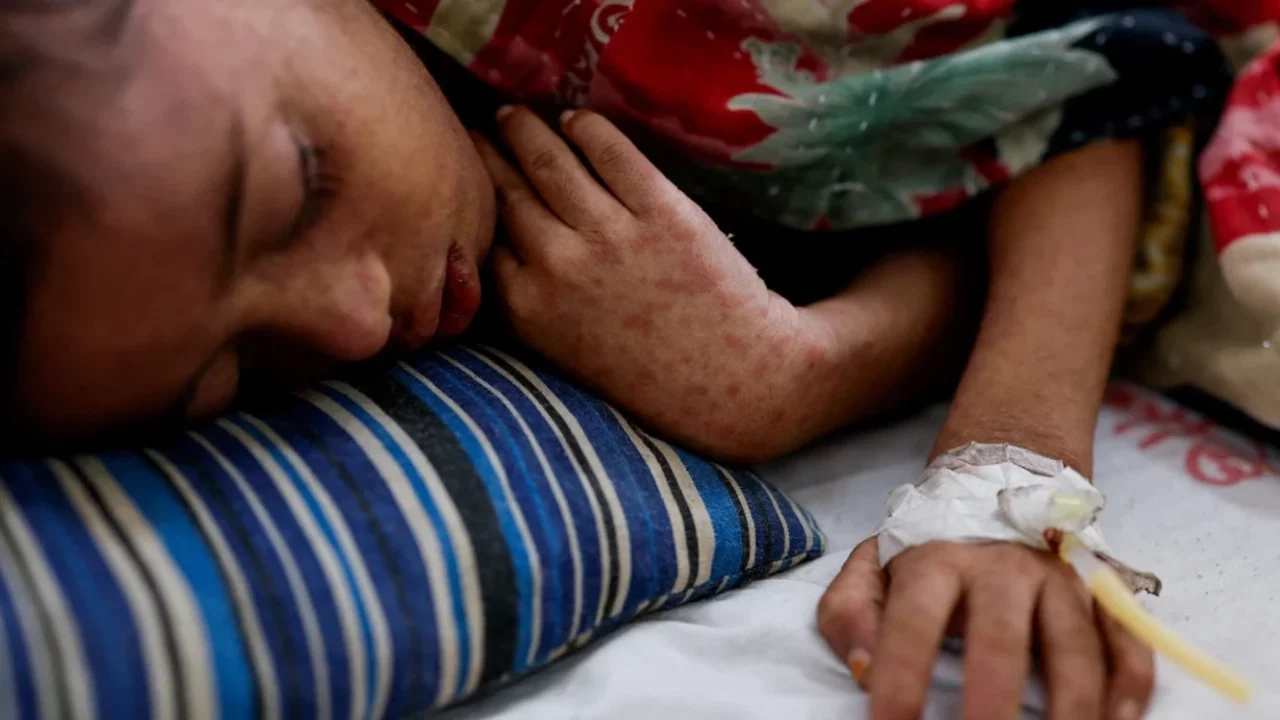 Bangladeş'te kızamık alarmı: 1201 çocuk hayatını kaybetti