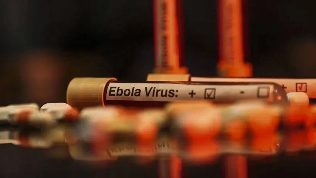 Nijerya'da ilk Ebola vakası tespit edildi: 44 temaslı belirlendi