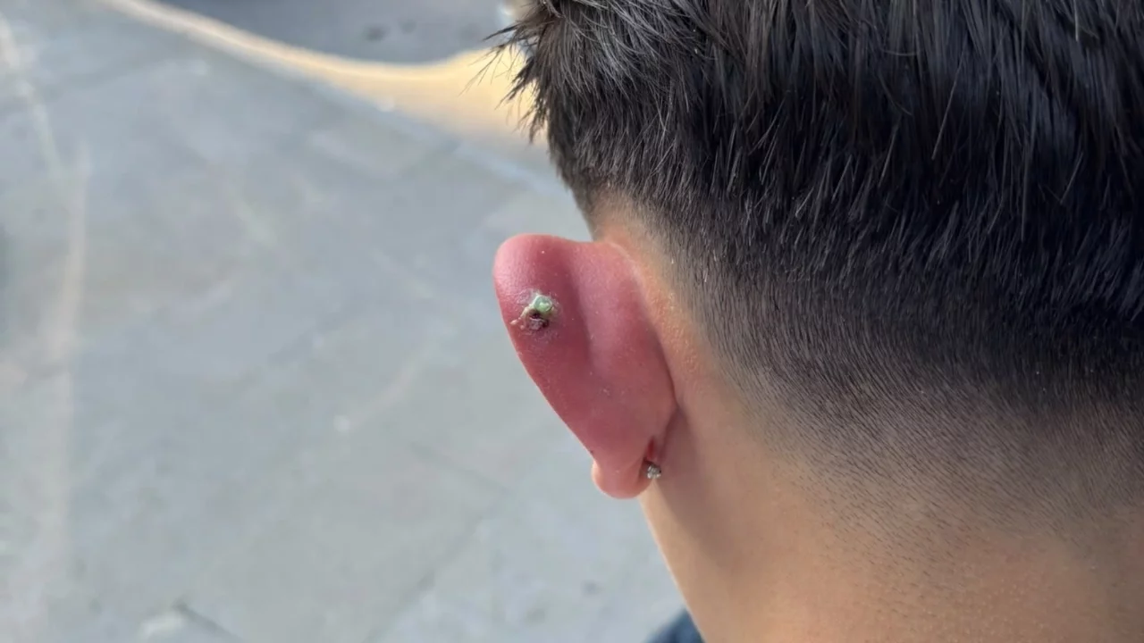 Bursa'da piercing olayında yeni gelişme: İlçe Sağlık Müdürlüğü ekipleri harekete geçti