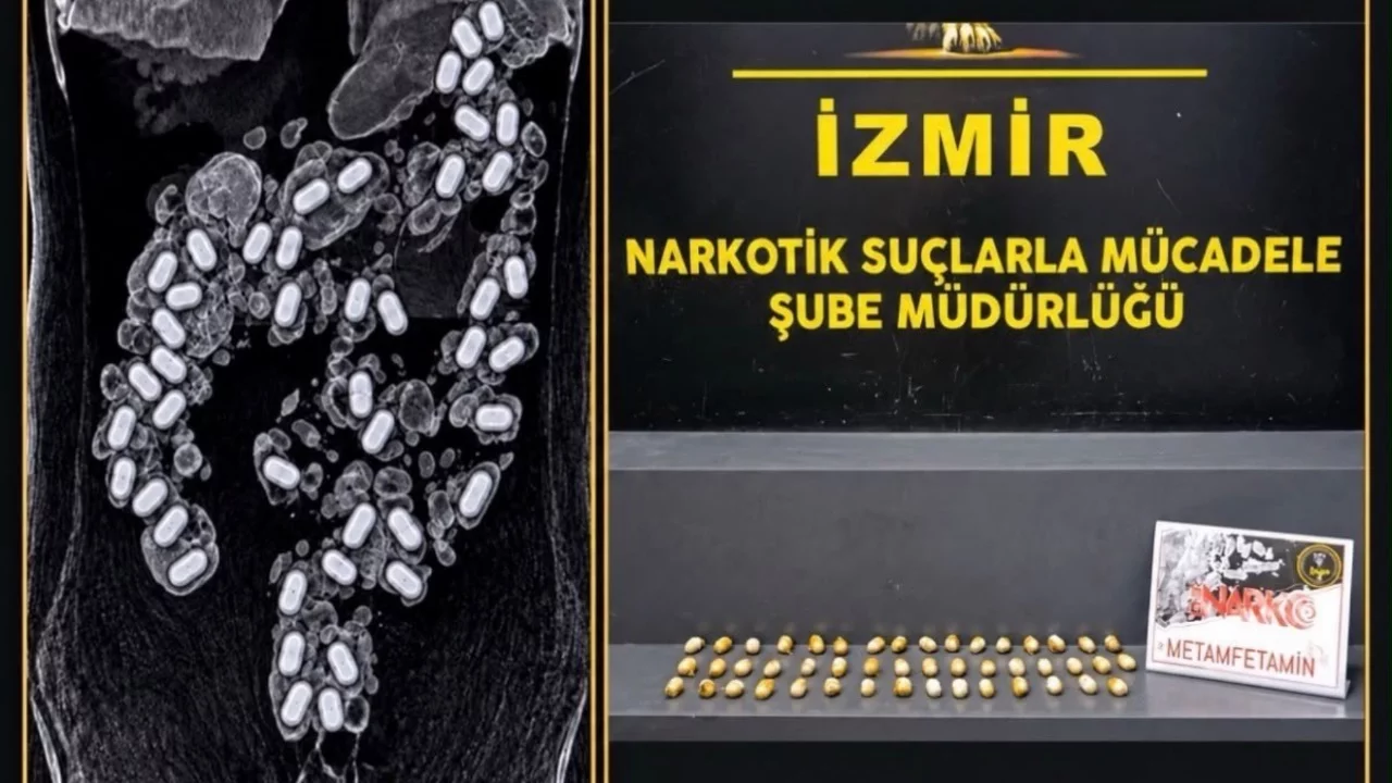 Havalimanında yakalandı, midesinden 47 kapsül uyuşturucu çıktı